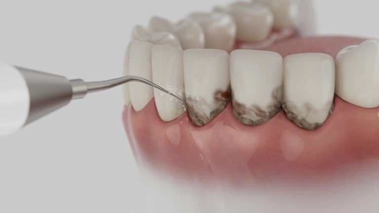 Reliable Dental contractor in Collinsville, MS by Dentist Open Now